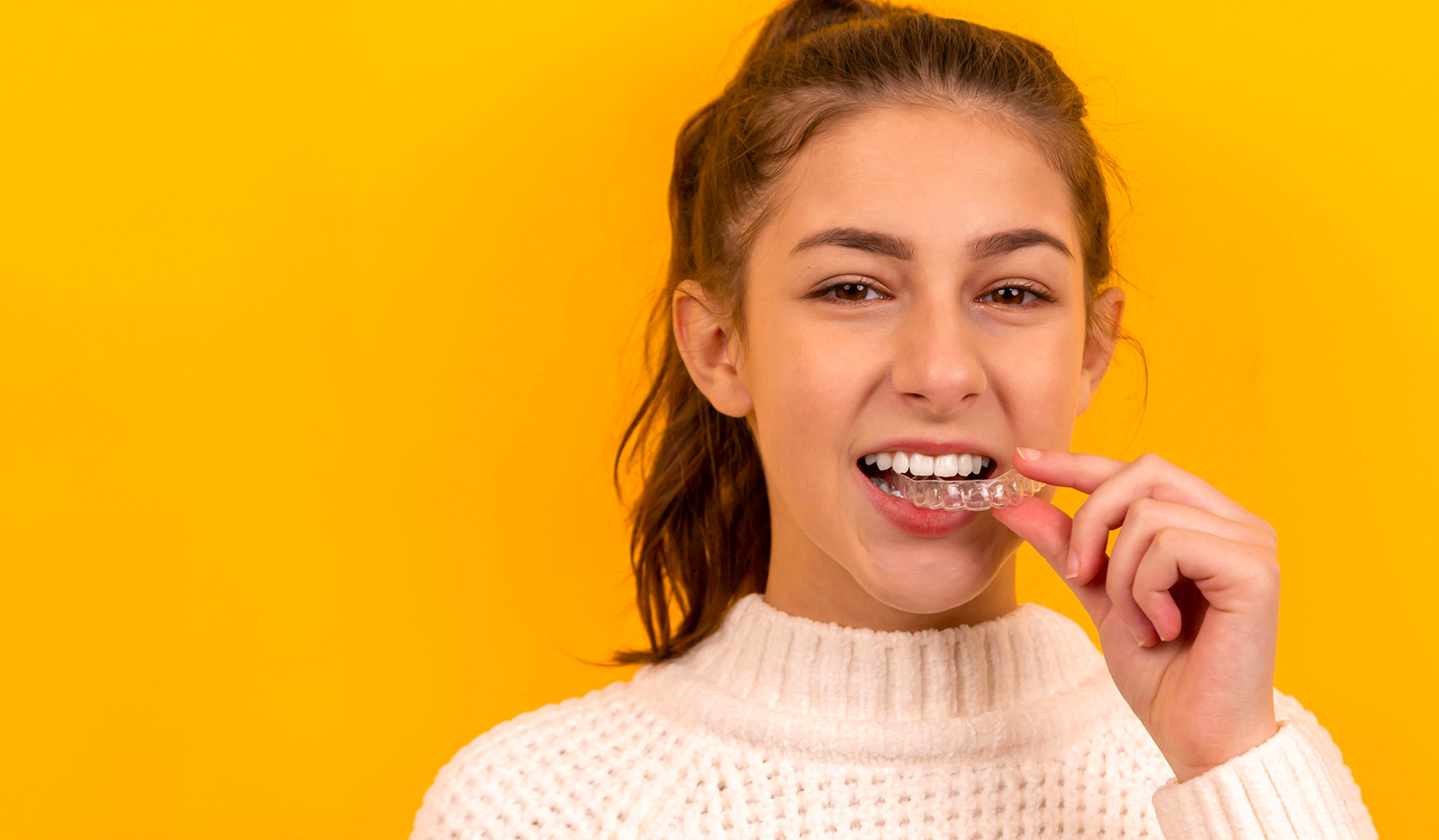 Patiente avec gouttière Invisalign